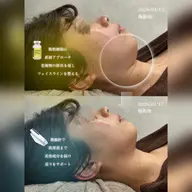 【まずはお試し2cc】小顔ケア🍋｜顎下・フェイスライン集中ケア✨
