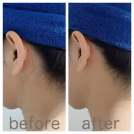 【本格シェービング】スタンダード襟足シェービング【アップスタイル・脱毛前処理に◎】