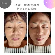 《期間限定》頭皮調整リリース➕小顔コルギ