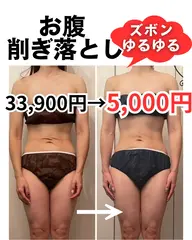 【初回限定】ぽっこりお腹1回で変わった！60分｜痩身エステ