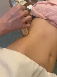 痩身エステ（Body）✨引き締めたるみ痩身効果❤️最新機器を使い脂肪除去♡