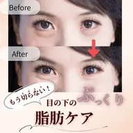 もう切らない！目の下のぷっくり脂肪ケア《体験2回》