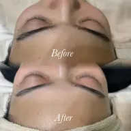 【動画撮影OKな方🎞⟡.·】顔シェービング+パック