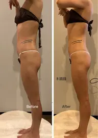 [美脚*美尻集中コース]ハイパーナイフEx+リンパマッサージ60分