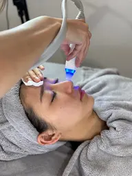 毛穴の汚れごっそりキレイに✨ハイドラ毛穴洗浄◆パック付き