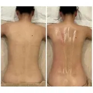 ※現金のみ方限定◎痩身モニター募集(ハイパーナイフとシェイプ短期集中痩身80分8回券→79800円