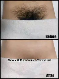 「レディース」VIOブラジリアンワックス