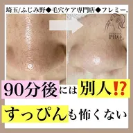 本気の毛穴改善Aコース(デコルテ&ヘッドマッサージ付)※毛穴エクストラクションプロ