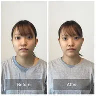 【アンケート特別価格】小顔ケアと骨盤ケア➕お悩み別オプション50分¥17900-〈小顔解消/姿勢ケア/顔の歪み〉