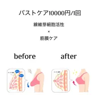 バストケア10000円/1回　（線維芽細胞活性×筋膜ケア）