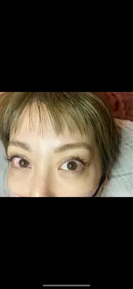 🧸LINE予約限定🌸150本＋アイSP＆育毛ケア込で4980円🎁