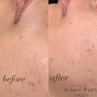 ４月限定☆フェイシャルワックス全顔☆6980円⇒3600円