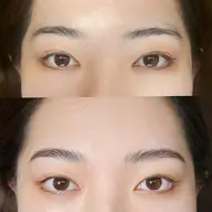 ハリウッドブロウリフト