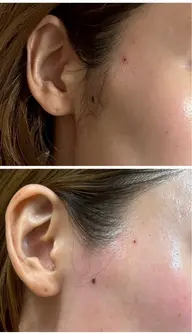 【お試し】部分ワックス　もみあげ