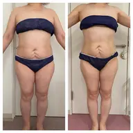 超音波、キャビテーション、EMSを使って美ボディに＊痩身エステ＊脚orお腹、1パーツコース