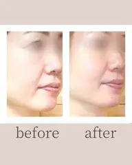 【モニター】〈透明感・ツヤ不足に〉蓄積汚れオフ×代謝を整え、内側から明るい艶肌