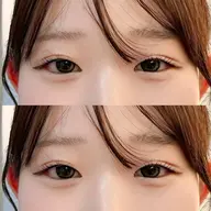 ꒰🍒全員クーポン🍒 ꒱マツパ2回券¥7700☁️*.+゚1回コーティング付き💌