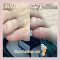 【副爪1箇所】痛い!引っかか！その不快感を解消します。