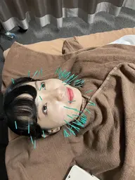 トータルエイジング美容鍼