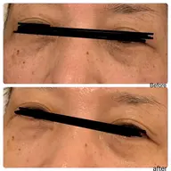 💆♀️オールハンドでフェイシャルマッサージ