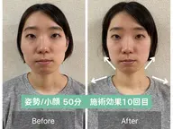 ｟🌸期間限定🌸口コミ投稿募集｠顔の歪み＋小顔整体・姿勢調整【50分15900→500円】
