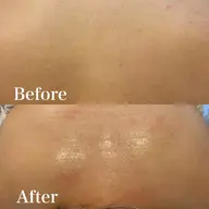 【女性】1部位大パーツ 足(膝上or膝下)・背中(上or下)・腕(肘上or肘下)・お腹(上or下)・バスト・おしり・脇