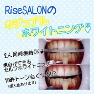 【セルフホワイトニング♡】👄✨1照射(10分)