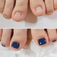 🦶【むしり癖・でこぼこ爪】🌿フット深爪矯正《ケア+長さ出し+ワンカラー仕上げ》