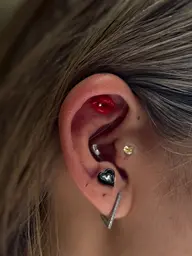 耳つぼジュエリー両耳8粒