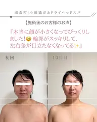 🌿 30代限定 3ヶ月間（6回来店条件）90分【顔むくみ解消/の余白をなくす小顔ヘッドスパ】