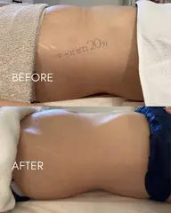 新！痩身メニュー「キャビゼロ」60分　部位は選択