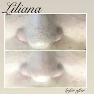 毛穴・毛穴黒ずみおススメ⭐️【剥離無し】REVI🌹ハーブピーリング🌹陶肌パウダー・酵素300種・シルクパウダー