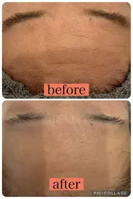 ハンドエステ、ソニックエステ、リンパマッサージ、パック