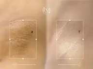 ラメラ　Lパーツ （脇、お尻の下、股ぐら、うなじ）