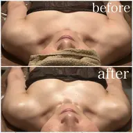 🫱オールハンドオイルマッサージ《上半身》🫲肩こり、巻き肩などを改善しつつ、背中の施術でウエストラインも整います🌟