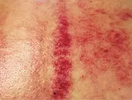 【中国カッサ療法】カッサリンパ全身《180分》+カッサヘッド+カッサフェイシャル《60分》