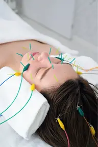 【小顔/リフトアップ】電気美容鍼コース