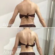 【華奢✨上半身集中スリムケア30分】（首・背中・二の腕)硬くなった筋膜を丁寧にほぐしこりケア、姿勢改善にも効果◎