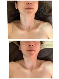 小顔リンパドレナージュとフルボディケアコース