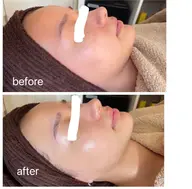 【1回で驚きのツヤ肌✨】陶肌トリートメント＋若化が叶うNMNオプションプレゼント🎁スキンケア半顔体験付