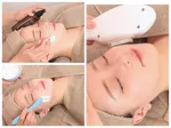 【ニキビケア/ニキビ跡ケア】毛穴洗浄＆光フェイシャル✨ニキビ跡とさよなら❗️クリアな美肌に！