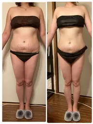 【ラジオ波痩身エステ】全身(顔なし) 排出リンパ＆セルライト潰し