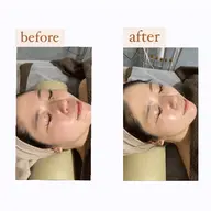 【韓国肌管理✖️顔脱毛🫧】白玉酸素セラピー+LED＋顔脱毛