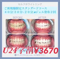 U24ミニモ学割🧑🎓ご新規様限定🦷スタンダードコース40分(20分×2)✨メンズも大歓迎✨!☝️