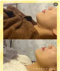 韓国初🇰🇷気になる脂肪へ集中的にアプローチして🍋ボトル