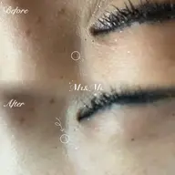 韓国式美肌毛穴洗浄🇰🇷💕【全顔】