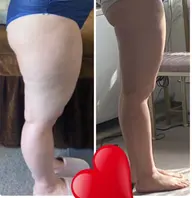 ミニモ限定🔥スピード痩身🔥美容整体付き！本気で痩身したい方に😊❤️限定3名様😋💪通い放題プラン🔥