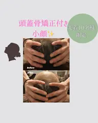 5名様限定【ホワイトデーキャンペーン！】3step小顔＋頭蓋骨矯正付き（100min）¥24,200→¥4,950