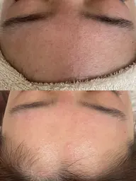 オプション●各パーツのみWax脱毛！他のメニューと組み合わせ(口周りのみ、鼻のみ、おでこのみ等)