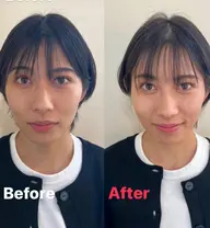 ミニモ限定！　クイックリフトアップ(10分) (施術者あり)リフトアップと小顔効果が期待できます🙆‍♂️